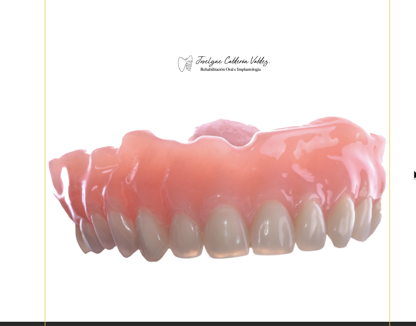 Prótesis total para restauración de dientes ausentes